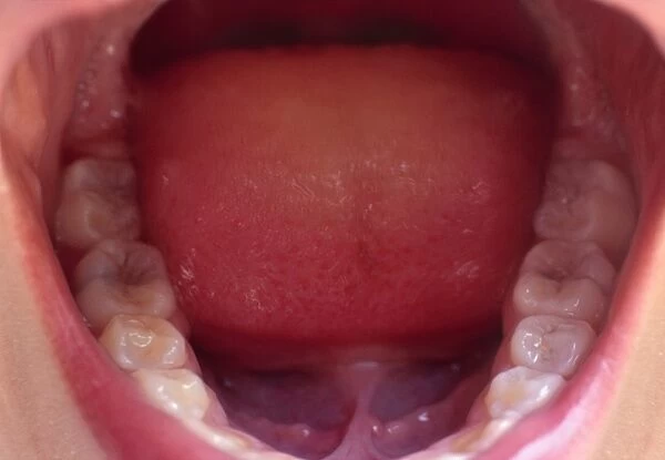 Childs molars and tongue