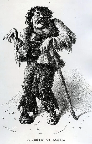 A Cretin of Aosta, c. 1870 (wood engraving)