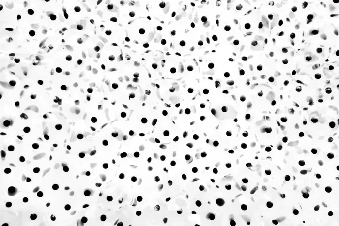 Framed Print : Close up of frog spawn, Haarlem, Noord-Holland, The Netherlands - Honorable Mention in the Black-and-White category of the Groene Camera 2022 photo contest Framed Print : Close up of frog spawn, Haarlem, Noord-Holland, The Netherlands - Honorable Mention in the Black-and-White category of the Groene Camera 2022 photo contest