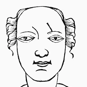PHYSIOGNOMY, 1658. Forehead of a man destined to die a violent death. Woodcut, 1658